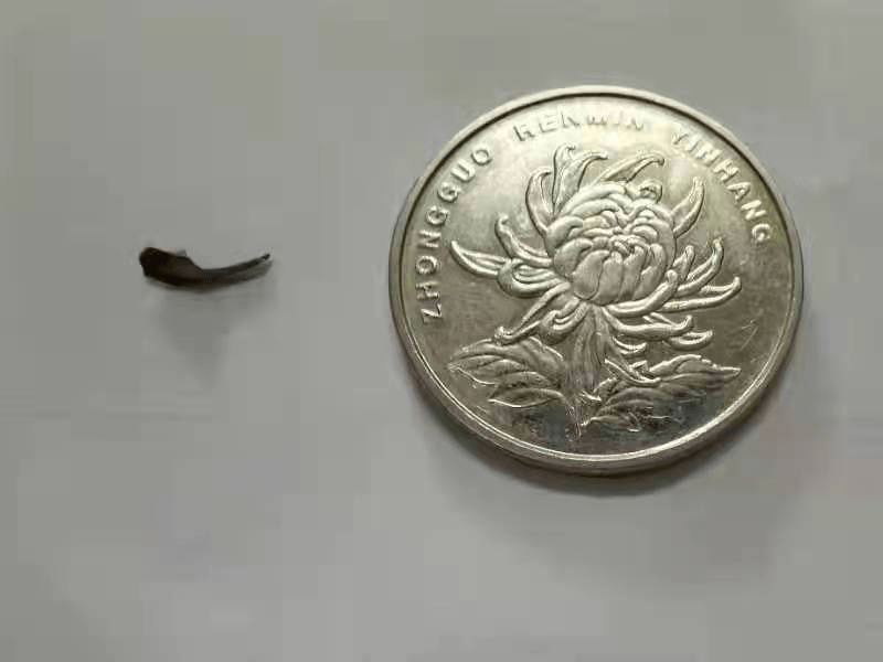 赵先生|男子干活时，电钻钻头蹦进眼里