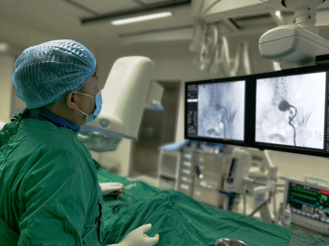 特色技术丨区人民医院介入微创术成功为患者摘除巨形动脉瘤