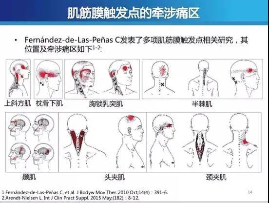 冯智英|“我想拧掉脑袋！”杭州15岁学霸一刷题就头痛欲裂！医生：这个习惯太差了，家长一定要看