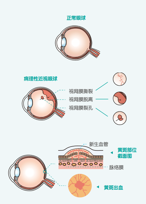 322eb9bffe704406a1349c86b15d5b5e.png