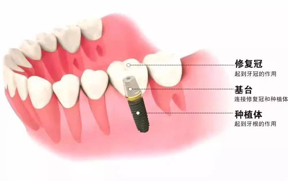 市民|@大连人！看牙消费福利券正在发放，符合条件的均可领取