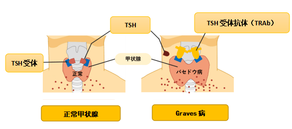 促甲状腺激素(tsh),与甲状腺细胞表面促甲状腺激素受体(tsh受体)结合