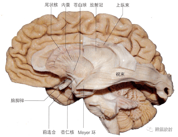 冠状切面(海马及其相关结构)左侧大脑半球水平切面上面观脑叶的分界和