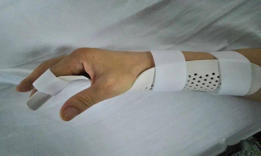 手部外伤术后康复方案及技巧一次性讲清楚