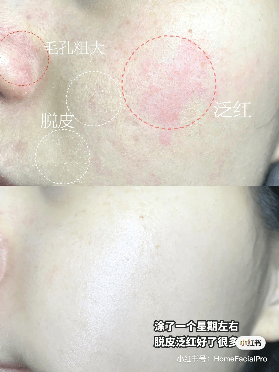 技术深秋，精致女人的变美思路