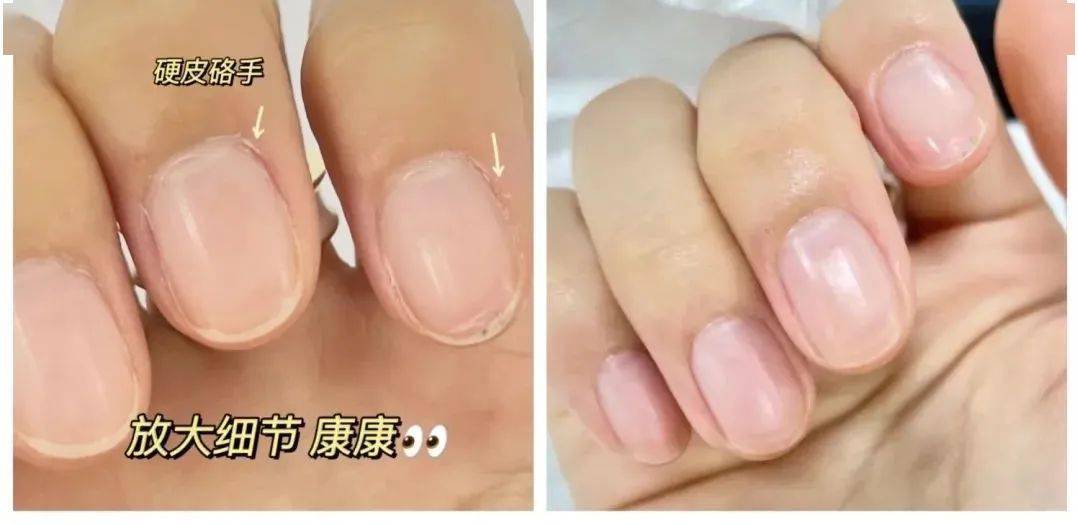 技术深秋，精致女人的变美思路