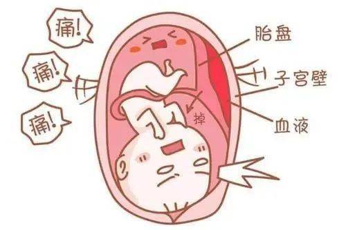 子宫胎盘图片