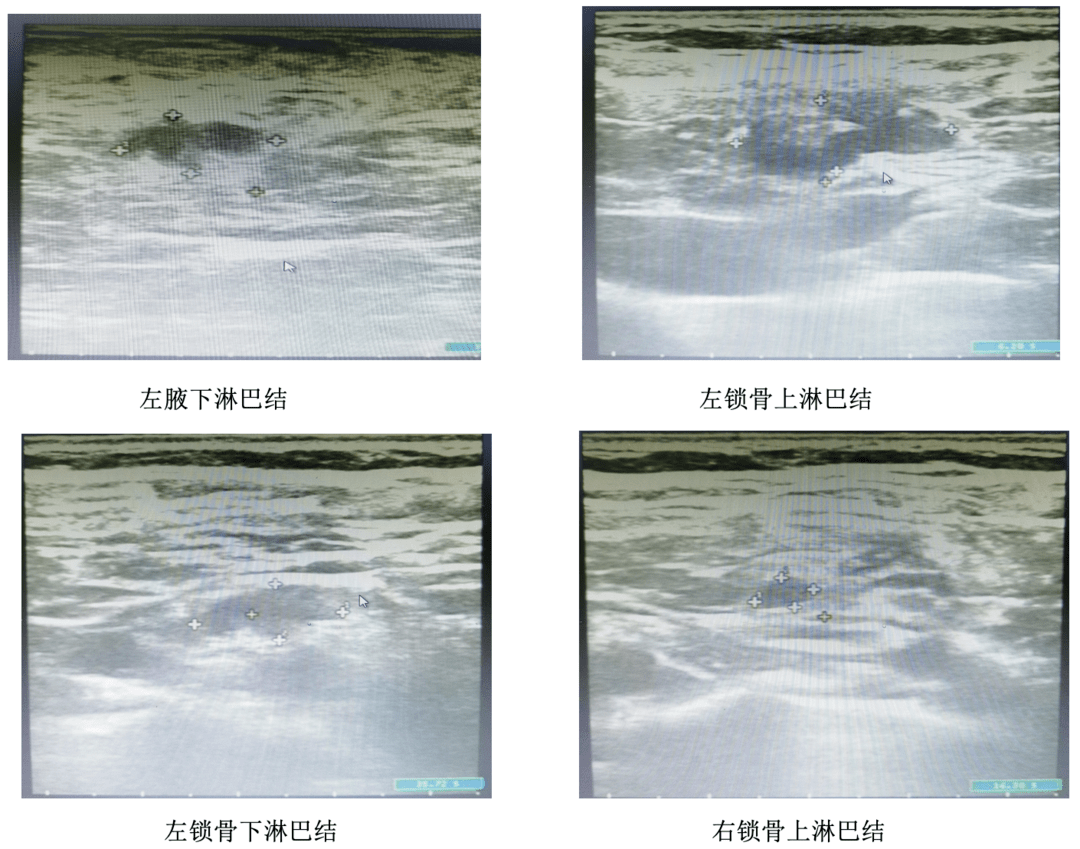 2019-1-10患者因