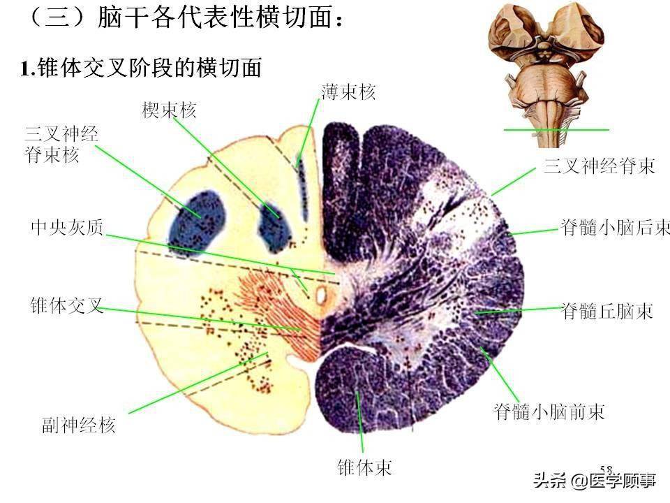 脑干的解剖结构