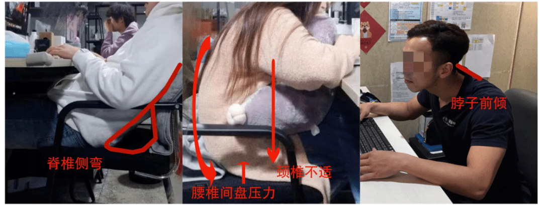 女生驼背vs不驼背穿同一件衣服差距到底有多大