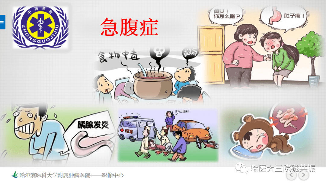 急腹症影像学诊断