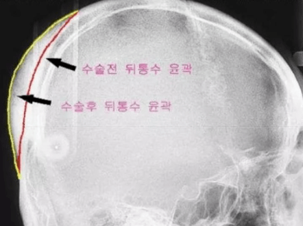全网全网都在吹的AI脸美女，和Jennie“撞款”的颜值秘诀是什么？