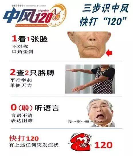 治疗|世界卒中日丨正确认识脑卒中,有这些症状的人要注意了!