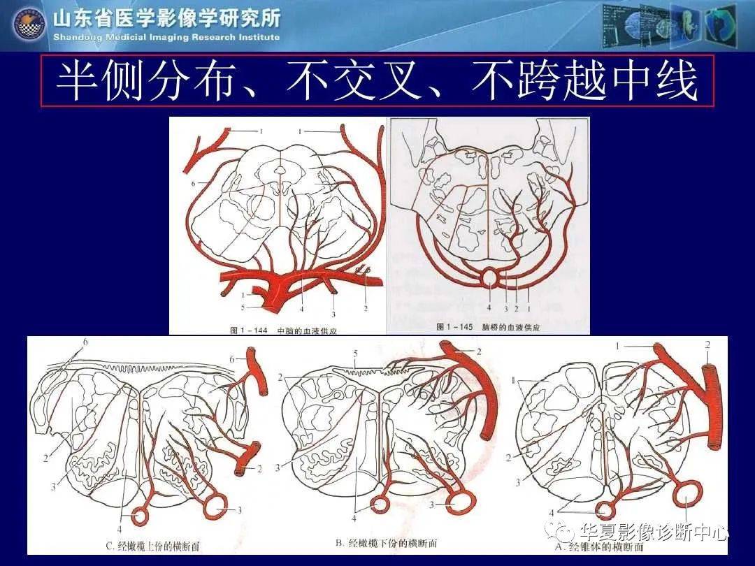 诊断|缺血性脑血管病的影像诊断