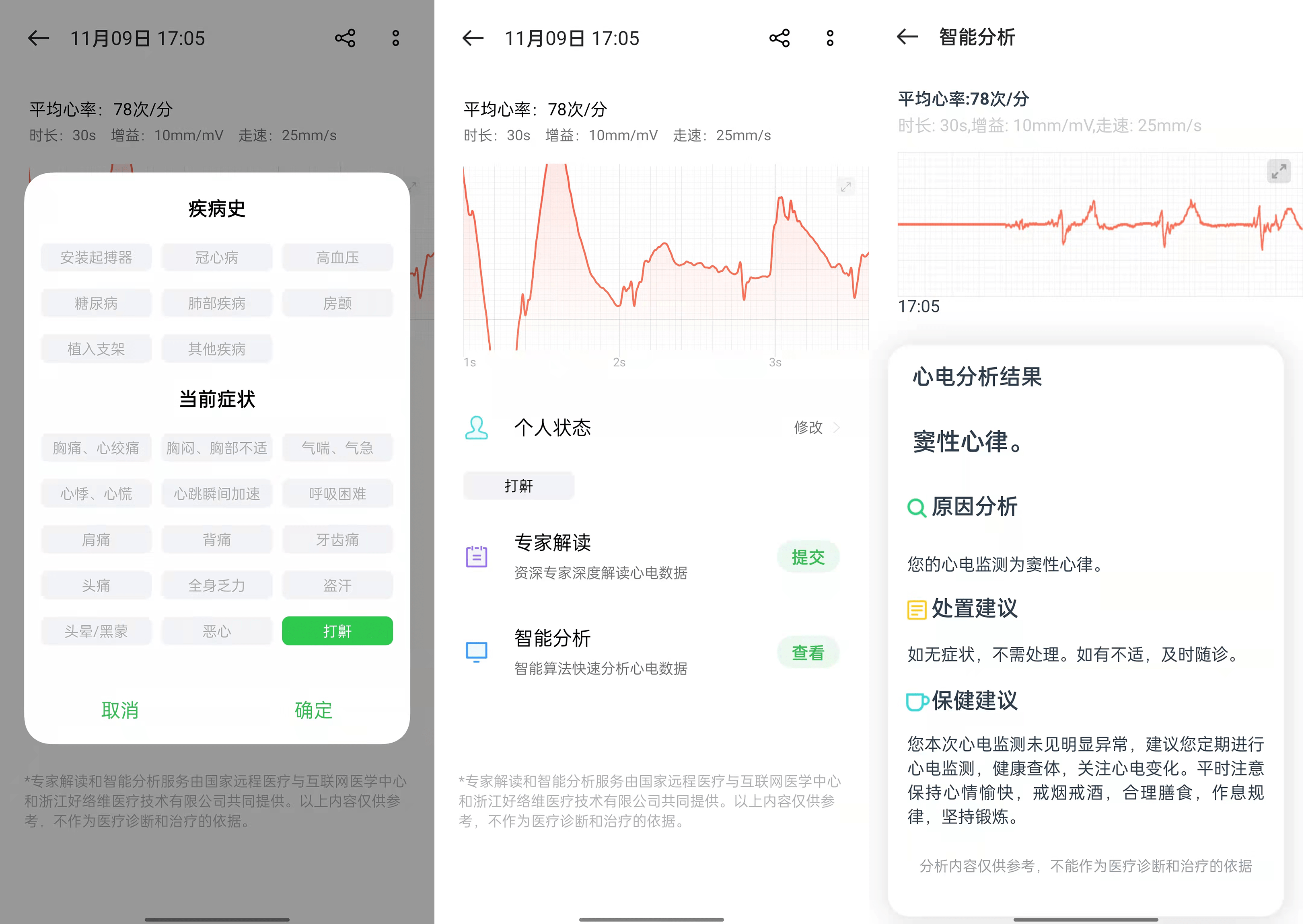 功能|OPPO Watch 2 ECG 版体验：在家就能测心电，像手机一样的智能化体验