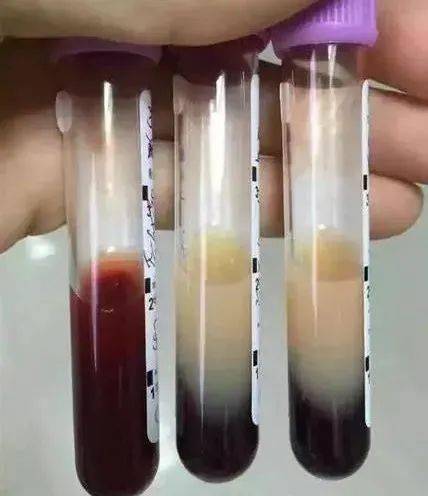 女子|广东一女子吃进ICU，血液变成“奶茶”色！冬天很多人这样干