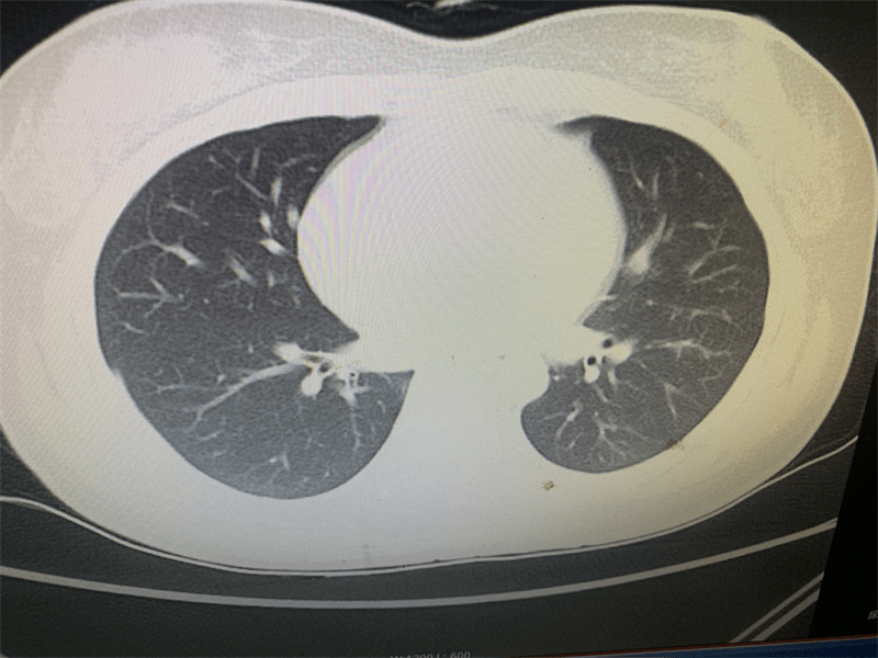 抢救|邵阳市中医医院成功救治一例敌草快中毒患者