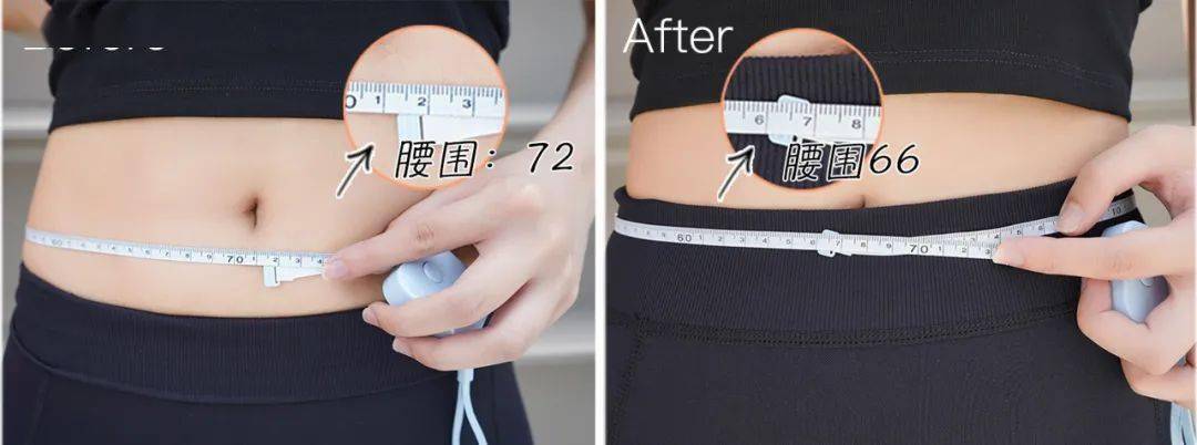 优惠 吴昕这次开挂了？从大象腿到女团腿她究竟做了啥？