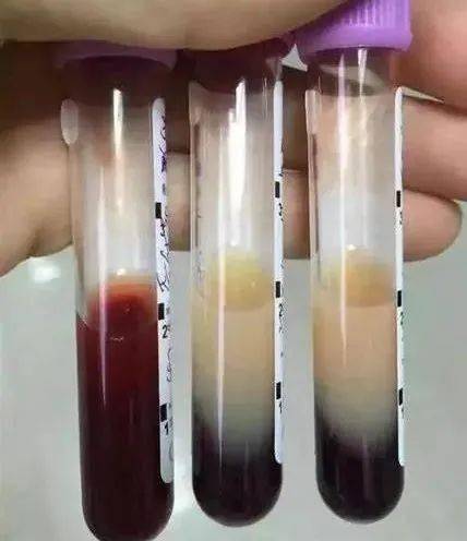 山药|53岁阿姨一顿吃了3斤牛肉+海参炖鸡，结果进了ICU！