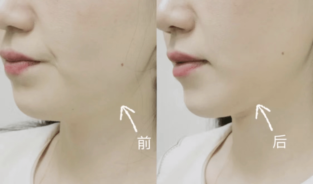 脸部女人的衣服,永远不嫌多