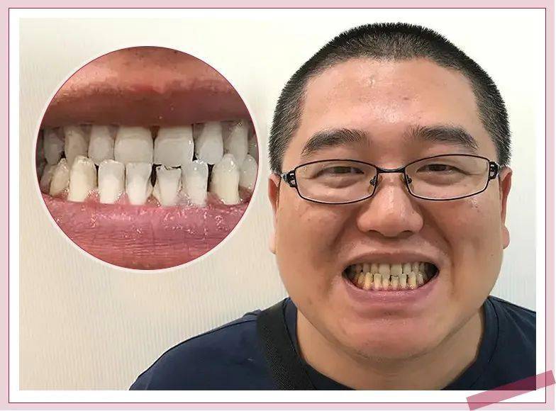 效果|又到火锅季，担心上火？降火神器了解一下