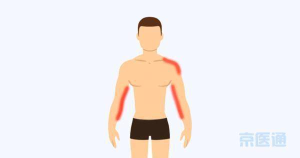 建议|心梗发作5大先兆，大多和电视剧里演的不一样！