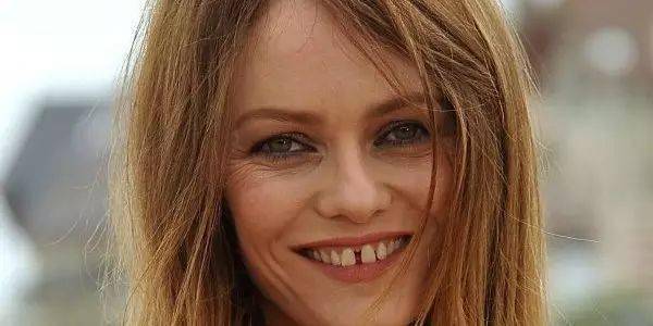 从豁牙总统到豁牙明星,法国人认为门牙缝能带来好运_dents