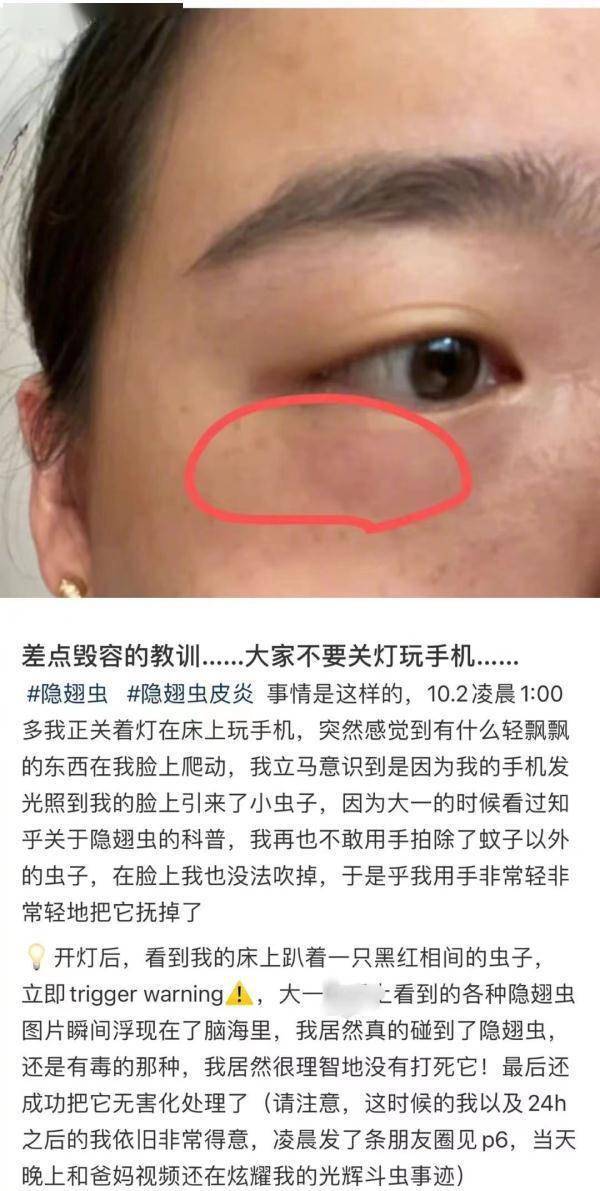 这种虫，是会飞的“硫酸”