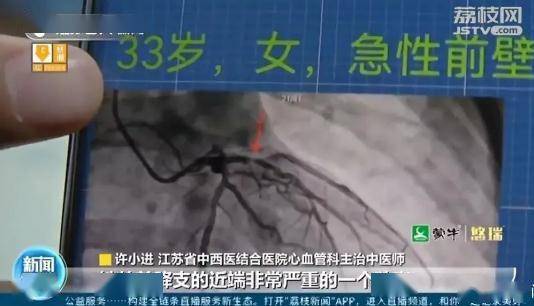 救治|13年吸10万+根烟，女子出现大问题！