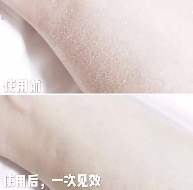 羊奶女生涂身体乳 vs 不涂身体乳，这差别也太大了吧！