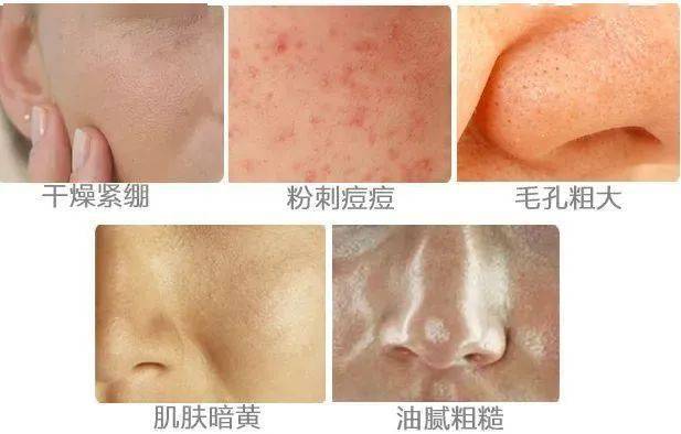 什么限量抢！89元抢海蓝之谜面霜/眼霜/精萃水！超强修复力！