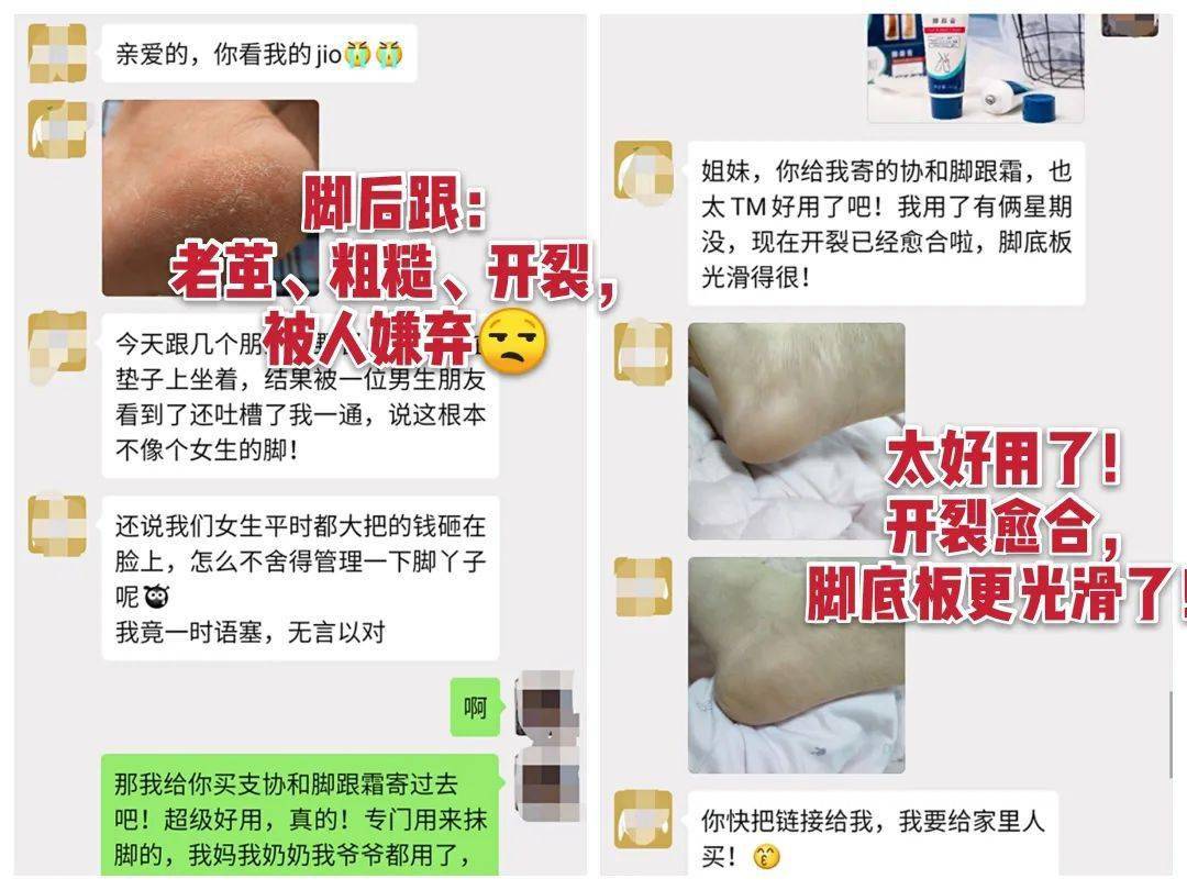 草本植物脚跟开裂、老茧、死皮……又疼又丑！用它一抹，双脚嫩滑，实测惊呆了！