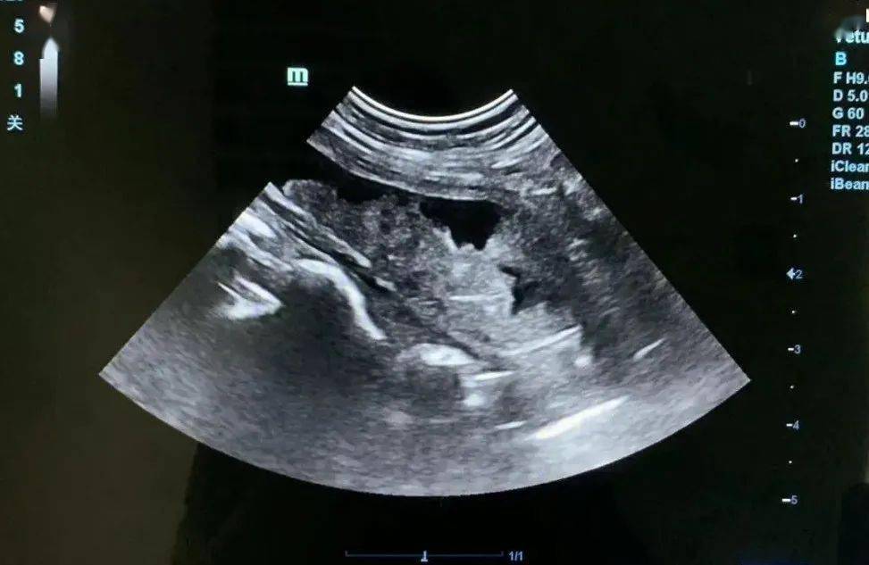 膀胱感染4,卫生情况较差3,进食含矿物质或人吃的食品添加剂较多的食物