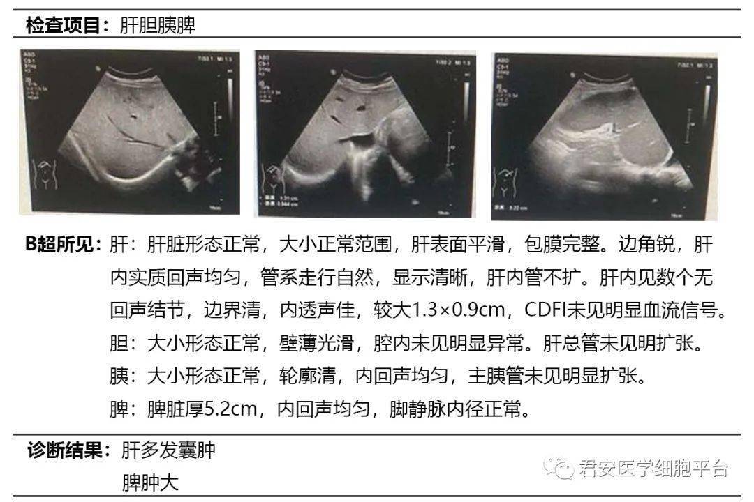 重庆市怀孕b超图片