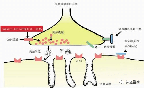 重症肌無力的治療要點:從膽鹼酯酶抑制劑到fcrn拮抗劑_免疫_麥考_細胞