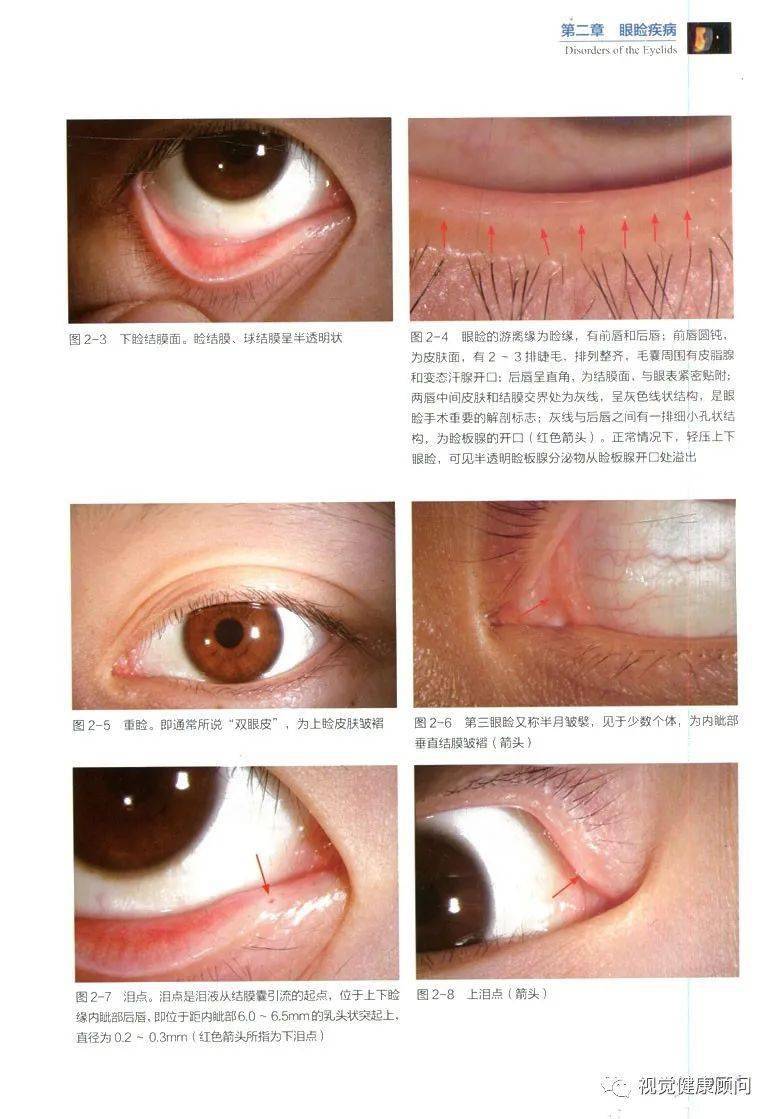 眼睛各部位正常值赶快收藏