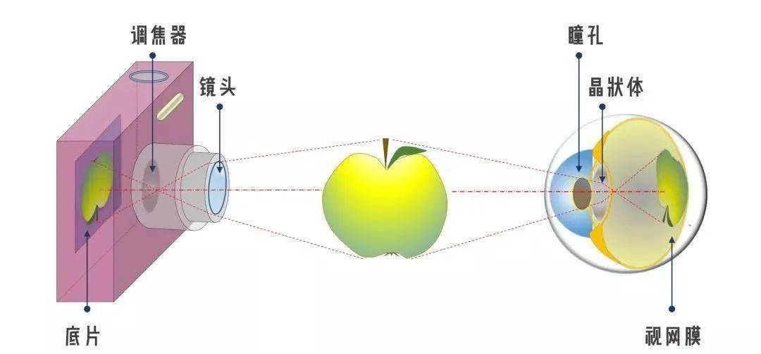 视觉训练近视康复孩子近视了需不需要做视觉训练