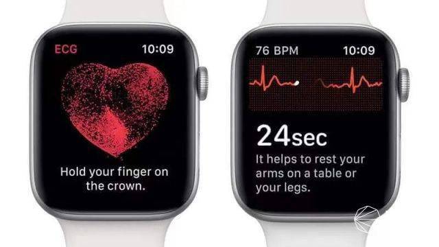 苹果|时隔三年！苹果手表「心电图」功能解锁，支持4款机型，快来看你的能不能用...