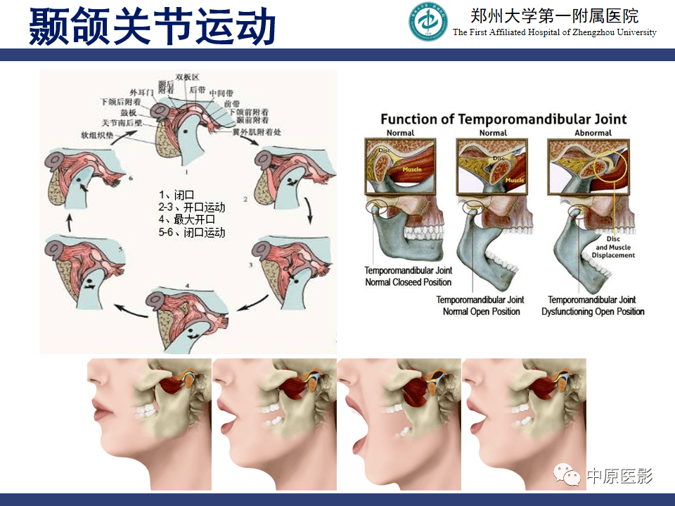 颞颌关节张口位图片