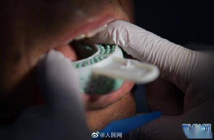 医保|种植牙是否可能进医保？