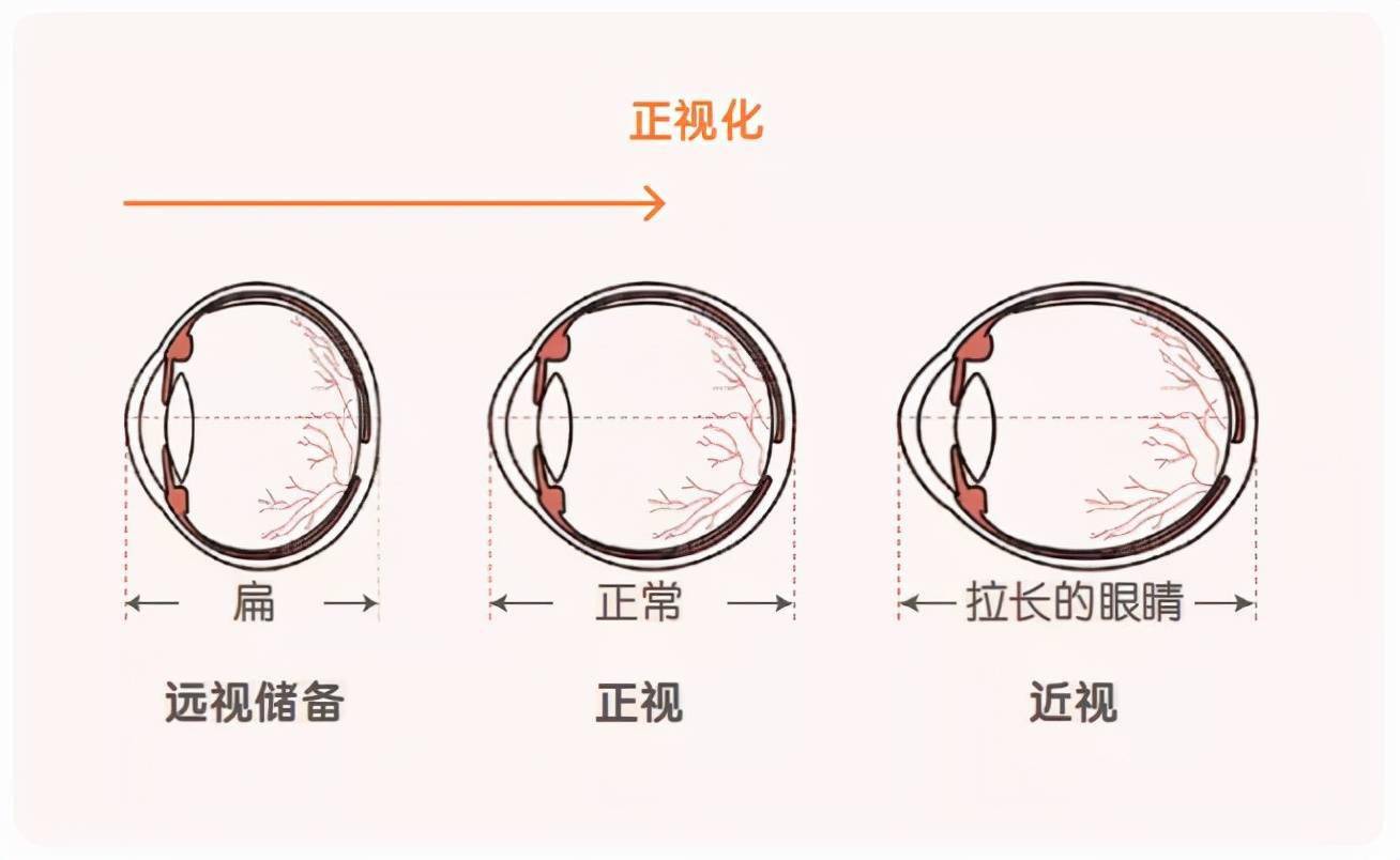 早知道早引导,让娃远离近视_储备_视力_消耗