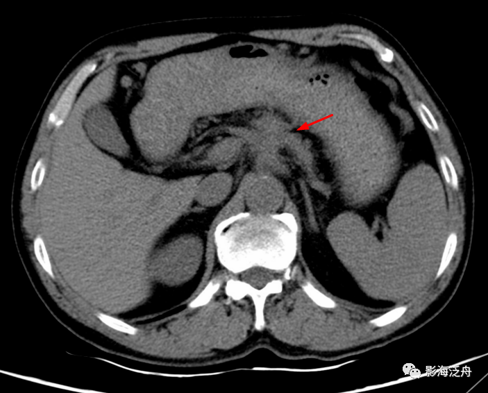 静脉|影像阅片，千万不能“掐头去尾”