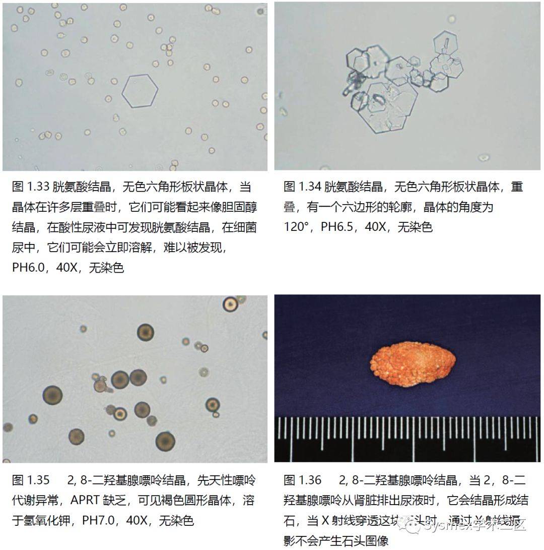 尿液结晶形态汇总_sysrnex_学术_来源