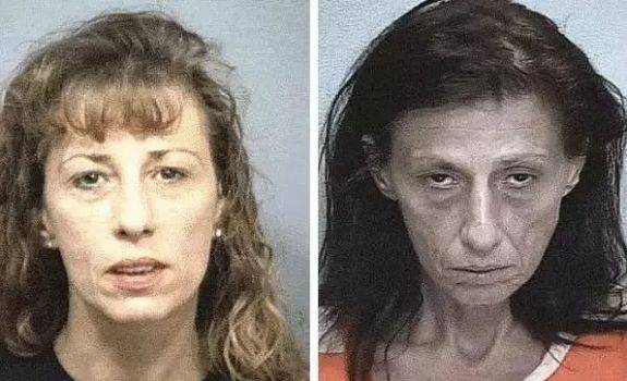 年▼一位23岁的疼痛药物成瘾的女性,右图是一年后的样子▼吸毒七个月