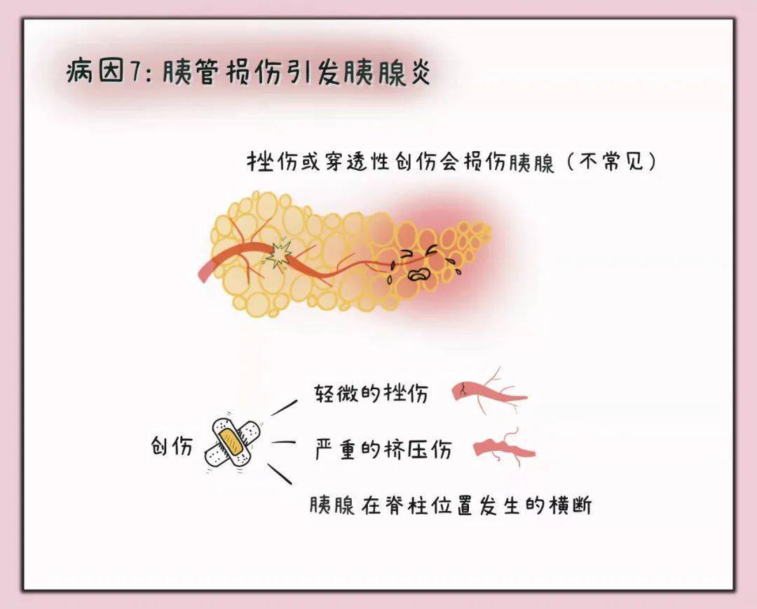 超高颜值急性胰腺炎公众与患者手册视觉呈现版yyds