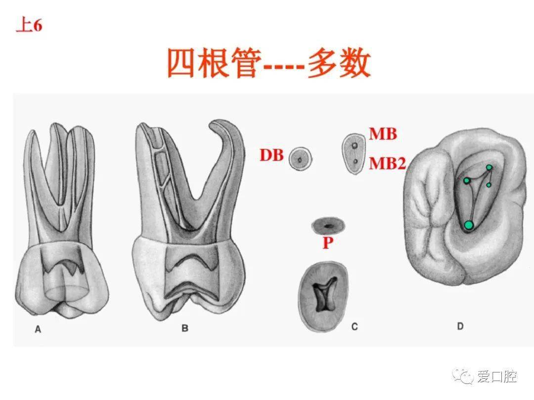 下6开髓图解图片