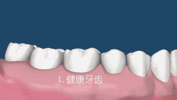 牙缝里|「牙齿橡皮擦」?一刷香口、黄渍消，二刷牙齿白如雪！