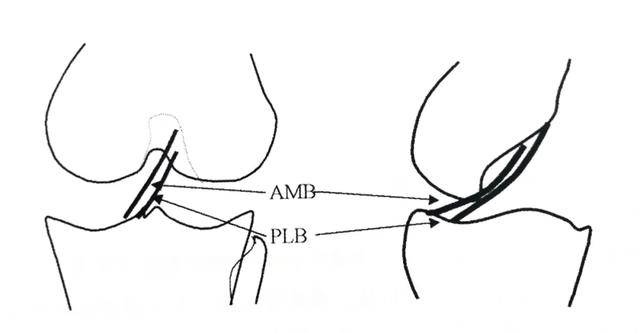 板股韌帶,髕支持帶,橫韌帶等,其中最易損傷的是前交叉韌帶和內側副