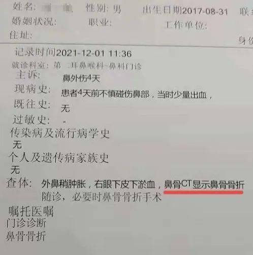 骨折病例报告图片