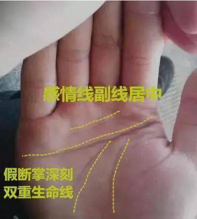 不仅假断掌深刻,还有双重生命线,根基深厚,运势很旺盛,事业会做得很大